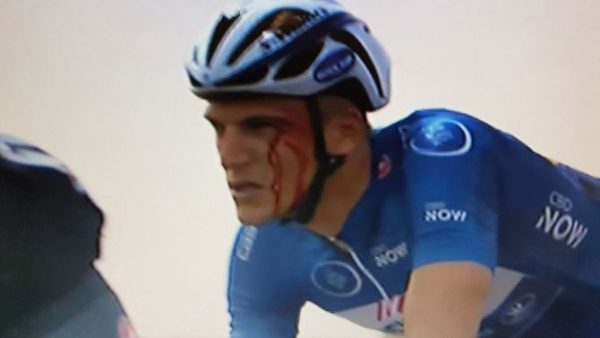 Marcel Kittel blood