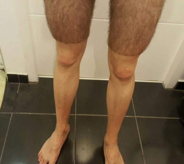 shaved legs